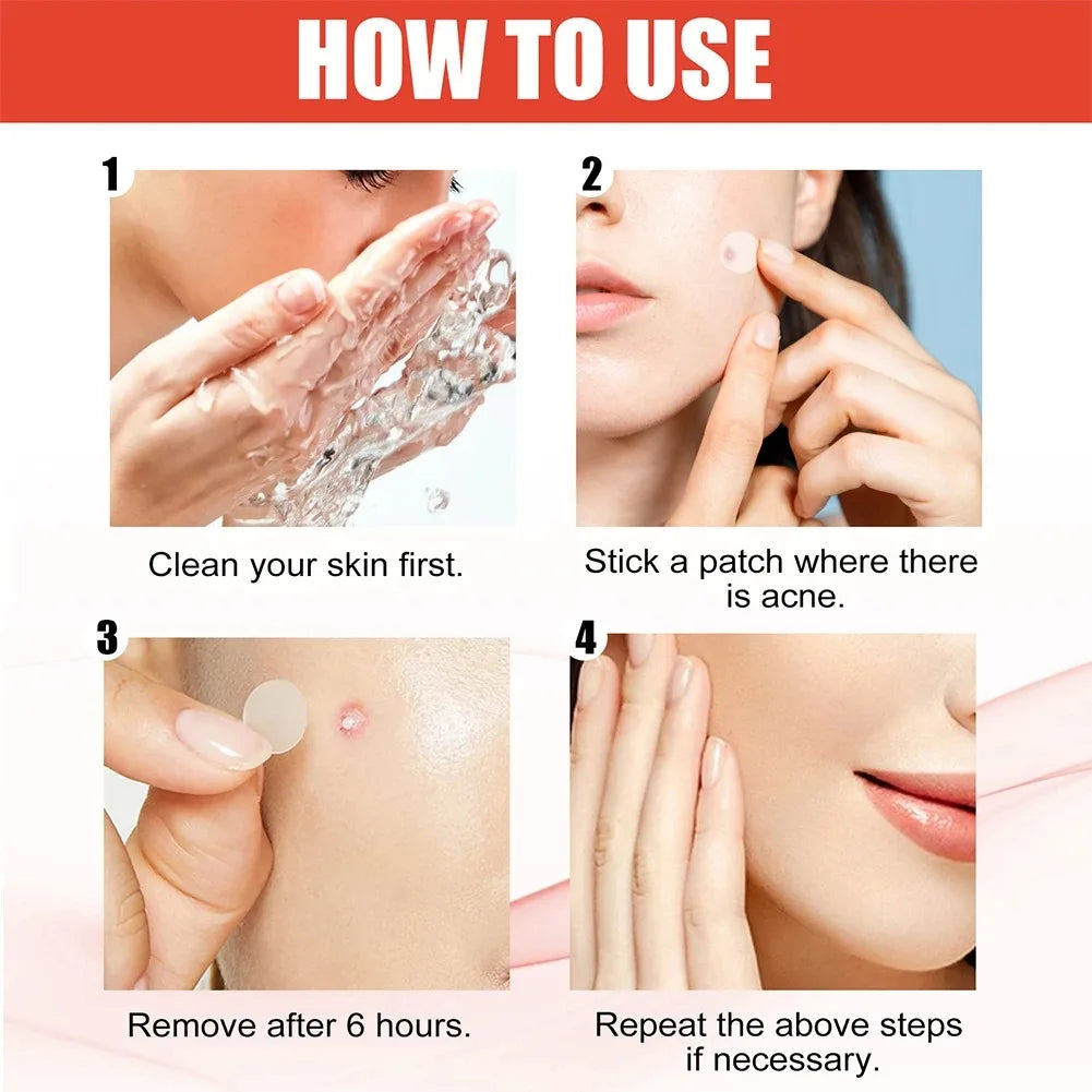 240pcs New Pimple Patch Acne Patches Heart/Star/Flower/Round Shape