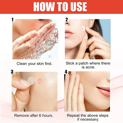 240pcs New Pimple Patch Acne Patches Heart/Star/Flower/Round Shape