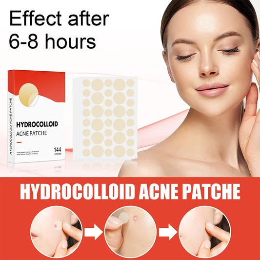 144pcs/set Face Skin Care Acne Pimple Patch 2 Sizes Invisible